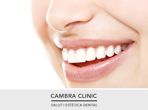 cambra-clinic-invisalign-cat